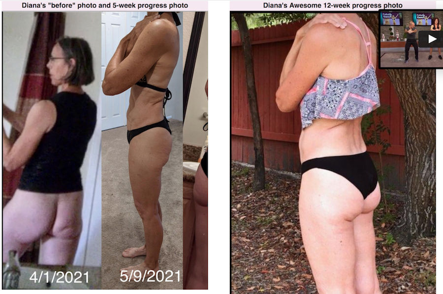 Diana B cellulite success story cellulite before and after progress photos side by side